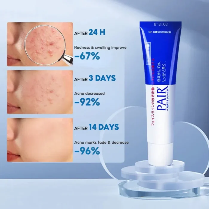 Pair Acne Cream W